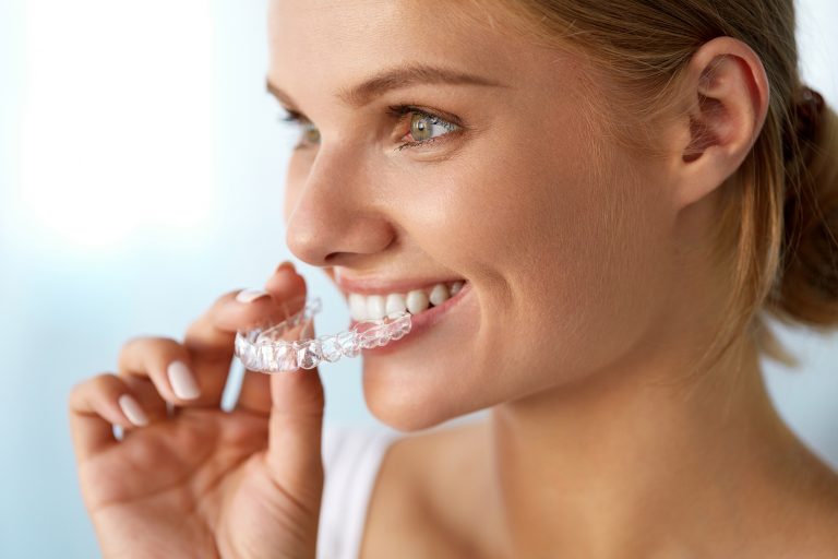 invisalign near you in etobicoke