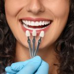 what are dental veneers and should you get them