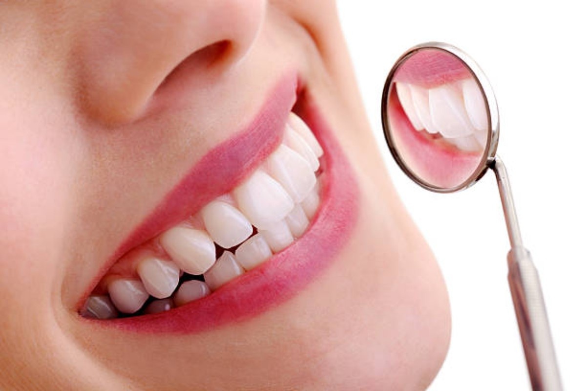 what is dental bonding procedure