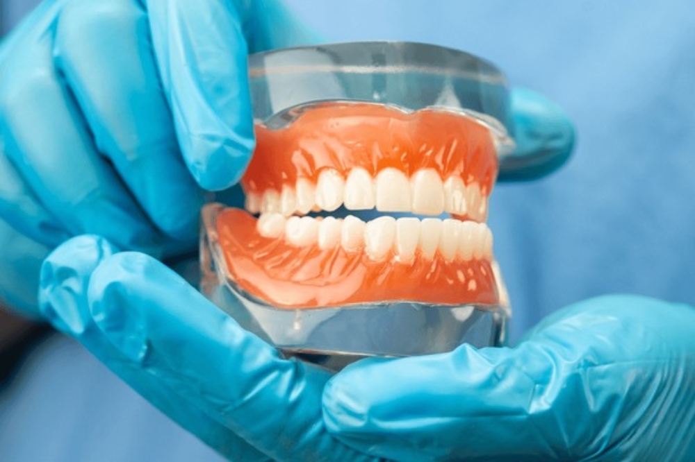 Dentures Explained A Complete Guide to Replacing Missing Teeth