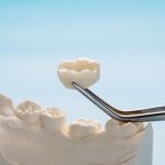 how long do dental crowns usually last